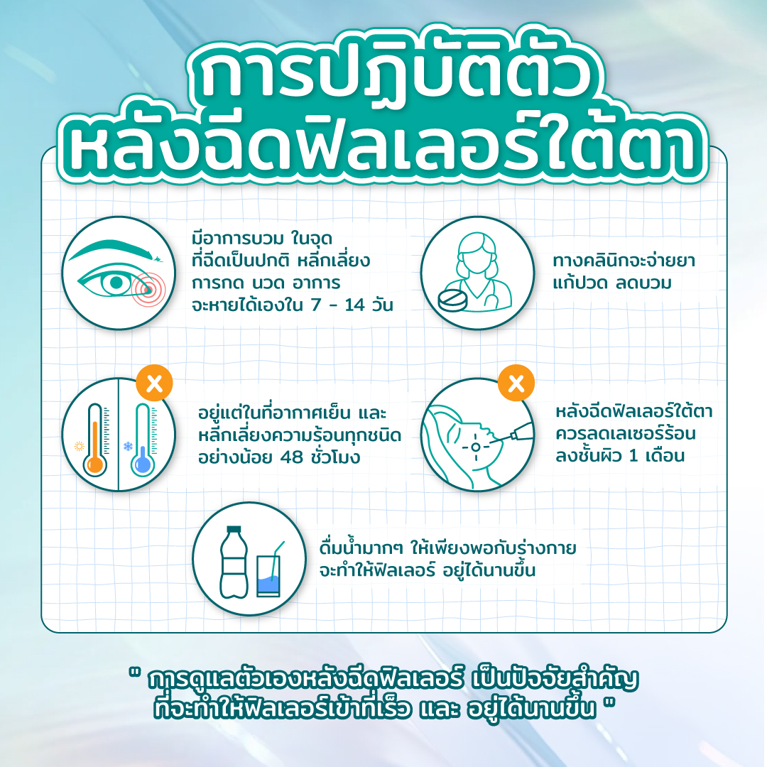 วิธีดูแลตัวเองเพื่อป้องกันฟิลเลอร์ใต้ตาเป็นก้อน